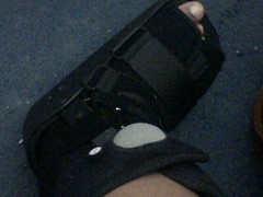 Broken foot