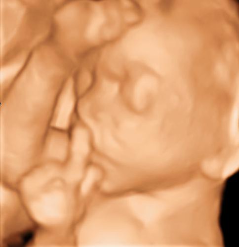 3d ultrasound pictures at 26 weeks. 3D Ultrasound image of Baby face 26 weeks
