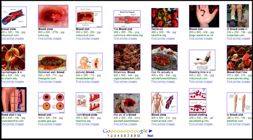 blood-clot-google