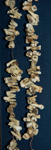 String of Teeth, Detail