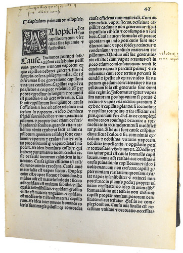 Page of Text with Woodcut Initial from 'Lilium Medicinae'