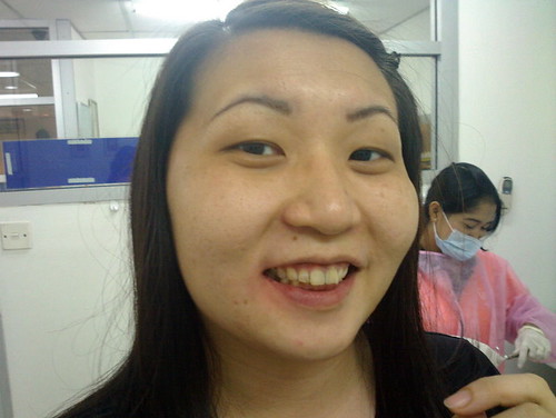Suanie after tooth extraction