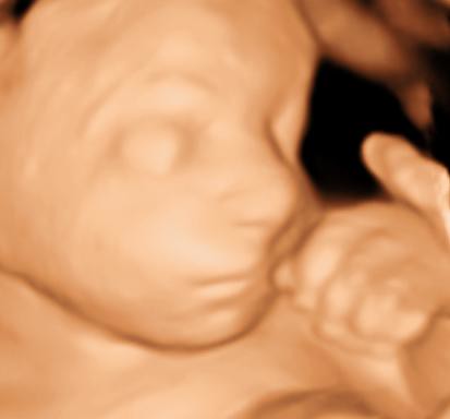 3d ultrasound pictures at 26 weeks. 3D Ultrasound image of baby face 26 weeks