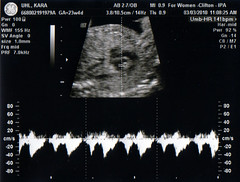 Ultrasound 2010-03-03 C