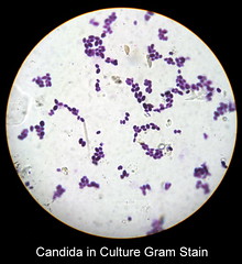 Candida in Culture Gram Stain