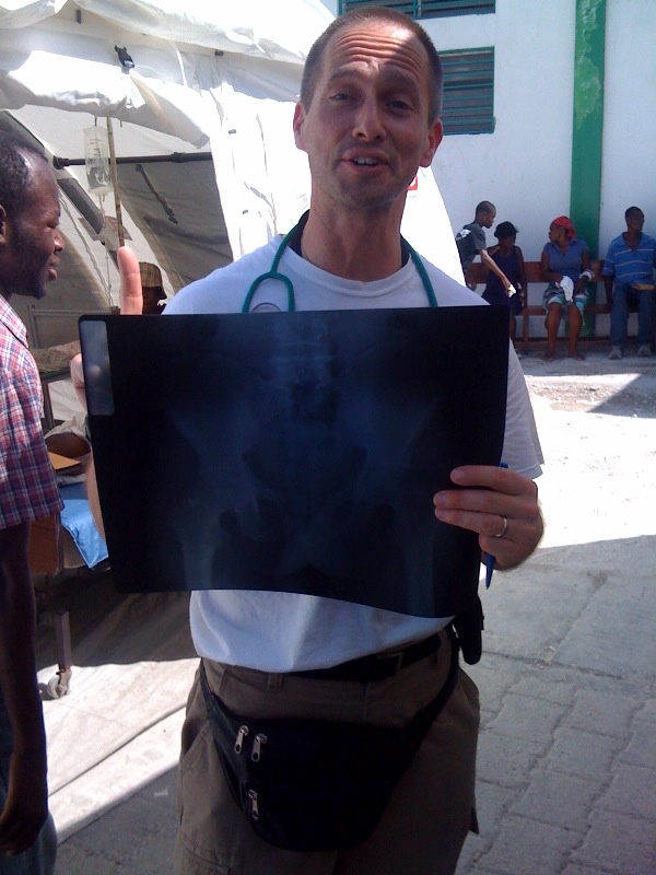 The very first x-ray #HaitiDrDispatch