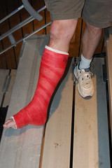 a injured leg