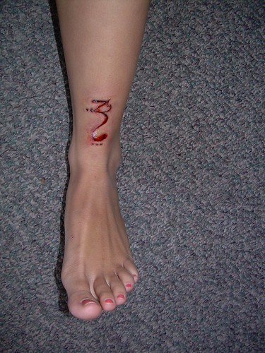infected tattoo. Infected Tattoo.