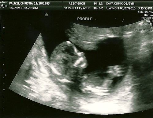 Baby #3 n/t ultrasound