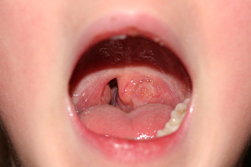 Hangy Thing In Throat 71
