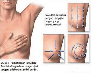 breast cancer , types of cancer, 