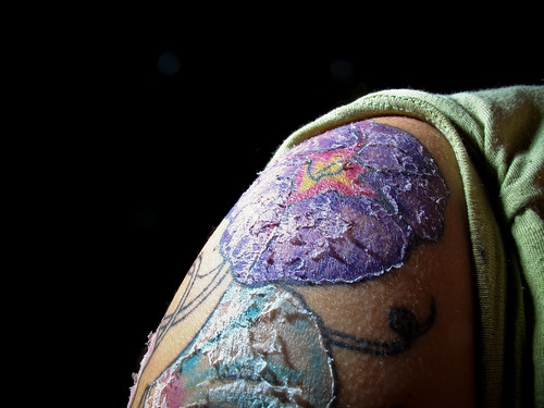 tattoo healing. arm. blue. gritphilm