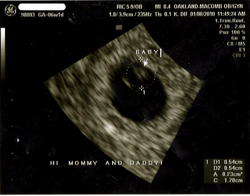 ultrasound 6 weeks