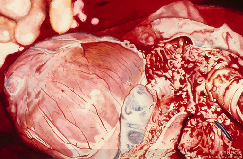 heart images medical. (Pigs Heart Medical