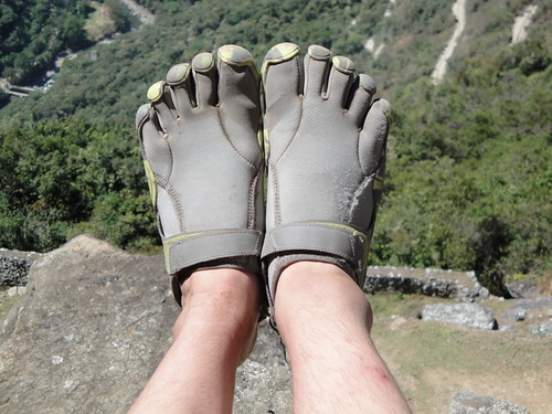 Vibram FiveFingers and a Swollen Ankle