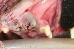 Extracted Canine Tooth