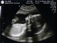 Ultrasound 2010-03-03 D
