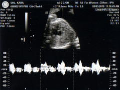 Ultrasound 2010-03-03 F