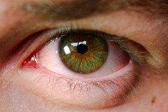 brown eye closeup blood eyes shot hazel randy wade bloodshot irritation randywade
