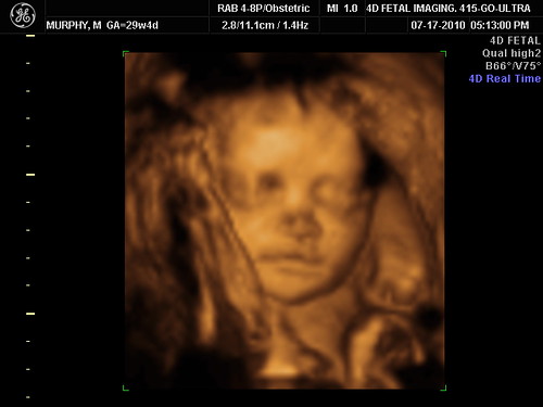 baby #2 ultrasound 29 weeks