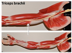 Triceps brachii, large arm model - Muscles of ...