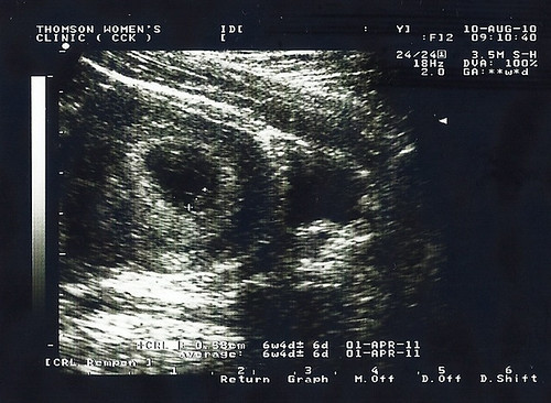 Ultrasound 2 - 2010