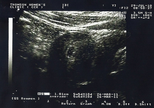 Ultrasound 1 - 2010