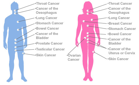 types of cancer, 