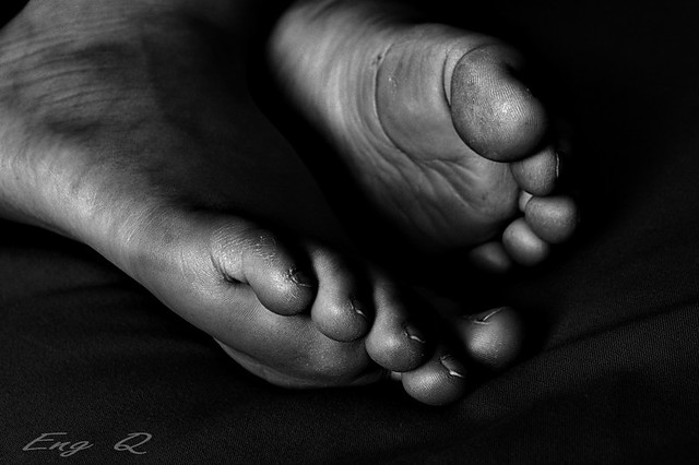tired feet small