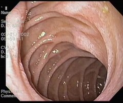 Normal_duodenum.aspx