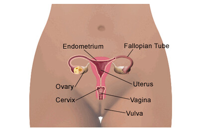 types cancer cervix