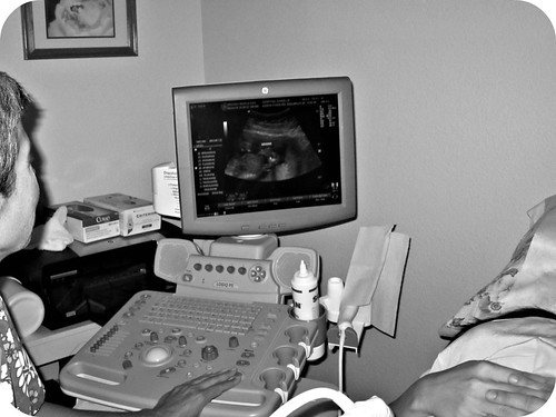 in the ultrasound room