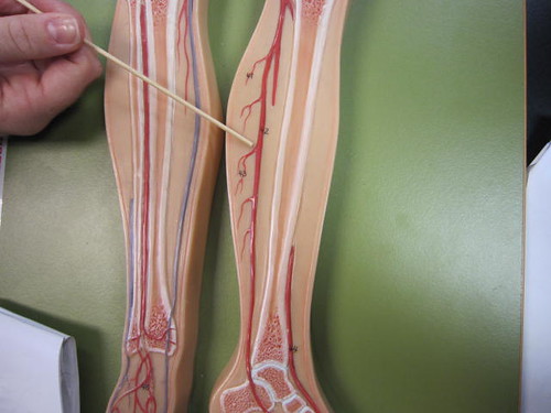 posterior tibial artery. posterior tibial artery
