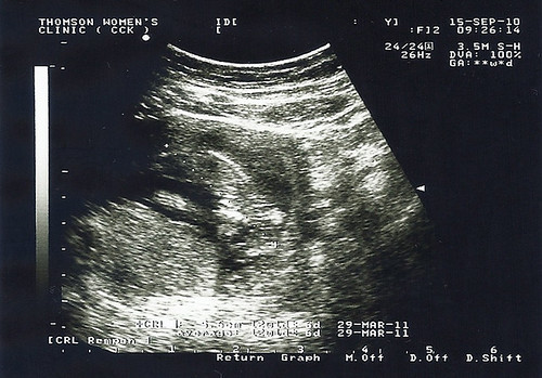 Ultrasound 5 - 2010