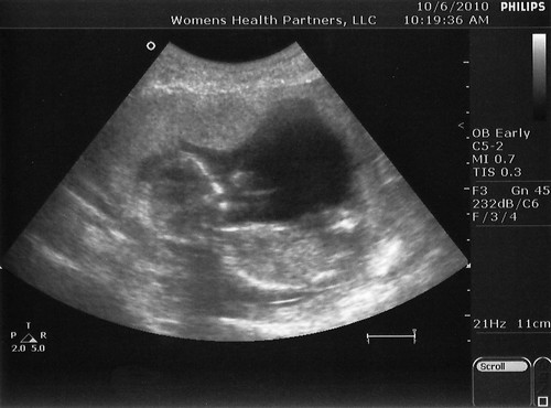 ultrasound 4