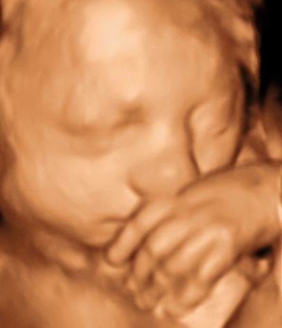dwyane wade lebron james chris bosh_6636. 3d ultrasound pictures at 26 weeks. 3D Ultrasound Gallery (Set); 3D Ultrasound Gallery (Set). deebster. Feb 15, 09:42 AM. I agree, it#39;s very annoying,