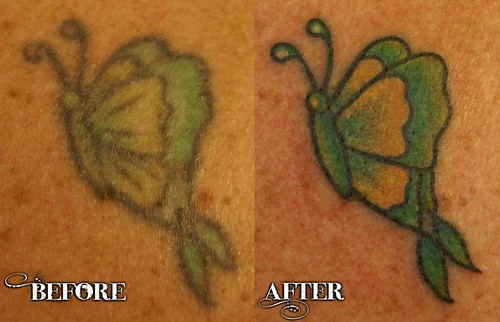  Lightning bolt tattoo restoration · Butterfly tattoo restoration 
