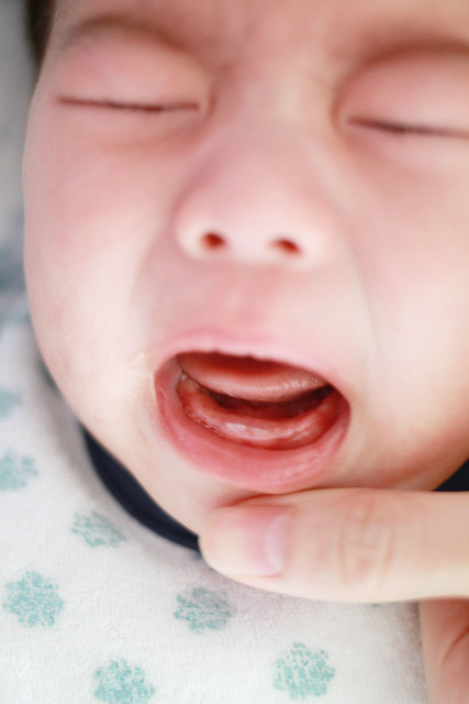 Baby Marcus' First Teeth