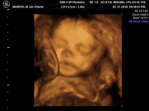 baby #2 ultrasound 29 weeks