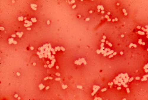 staphylococcus aureus gram stain. acid fast stain to the gram