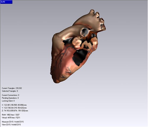 Heart Model 3D Scan