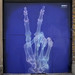x-ray hand sign