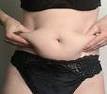 belly fat image