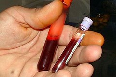 KUCHAŘKA: Znáte svoji krevní skupinu? 