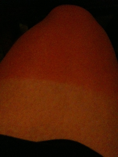 Sunburnt in a perfect line!