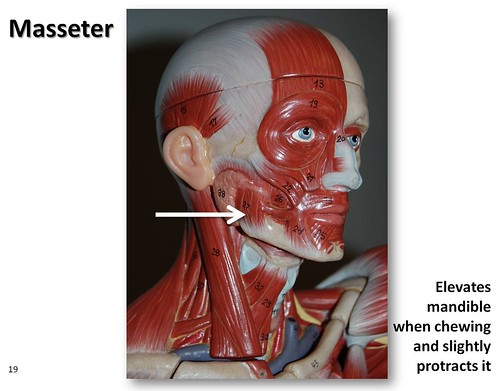 Masseter muscle