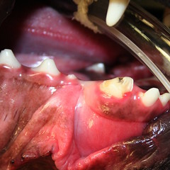 Broken Mandubular Canine Tooth