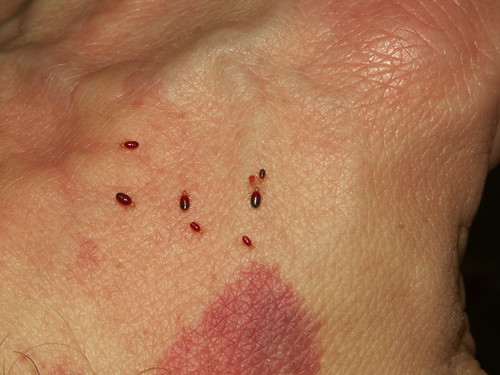 Small Red Bed Bugs