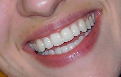 Anglų lietuvių žodynas. Žodis adult tooth reiškia suaugusiųjų dantų lietuviškai.
