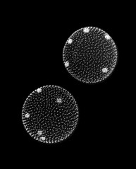Volvox sp. - Microscopic algae